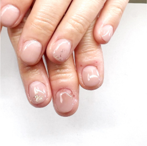 自爪育成ビフォーアフター